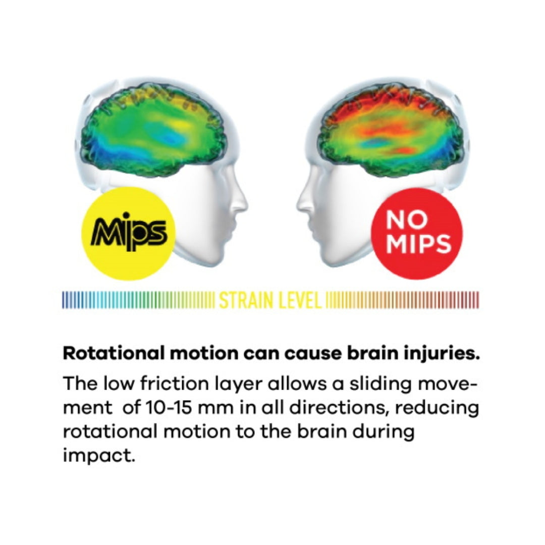 Comparison of MIPS and non-MIPS brain protection systems with color-coded strain levels.